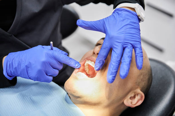Best Emergency Dental Care for Sports Injuries in Burnham, PA